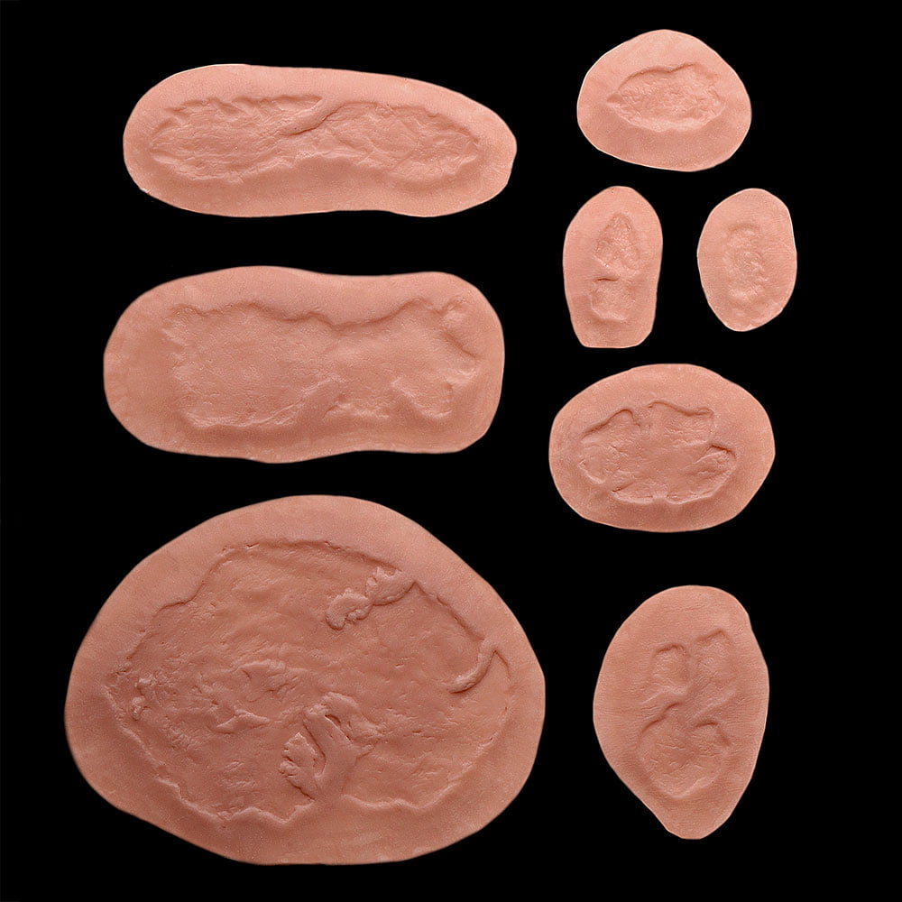 BR1 - Set of Fresh Burns
