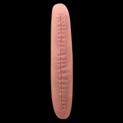 WD22 - Long Stitched Wound