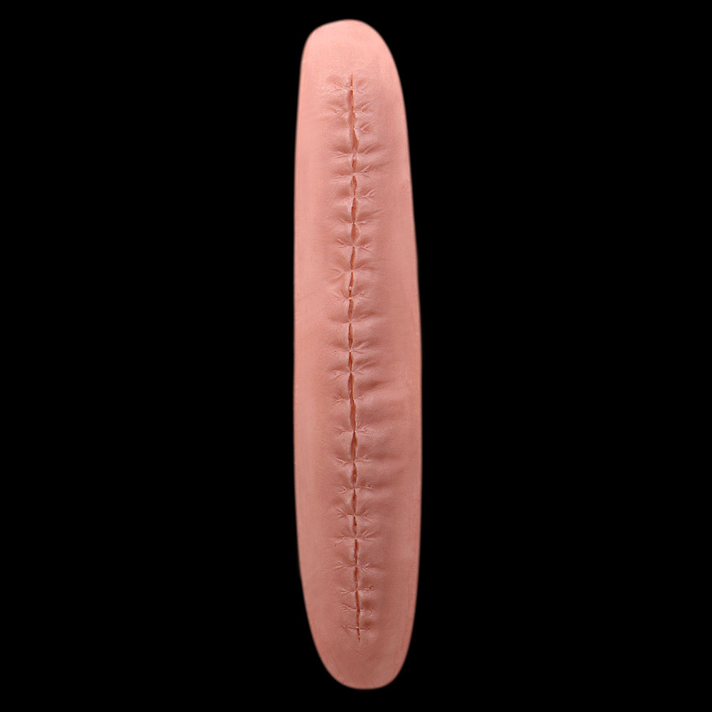 WD22 - Long Stitched Wound