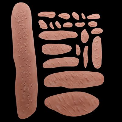 WD1 - Set of Keloid Scars