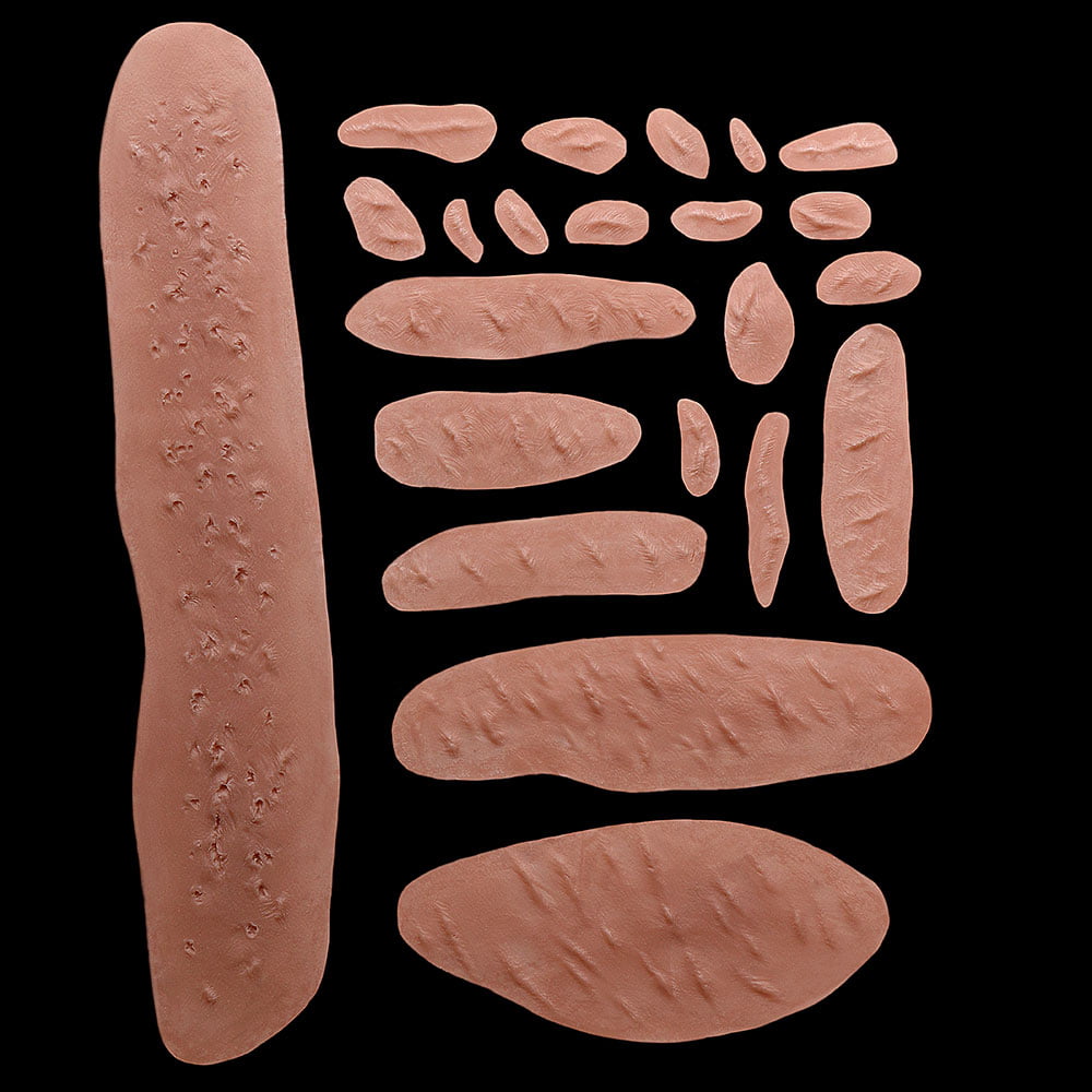 WD1 - Set of Keloid Scars