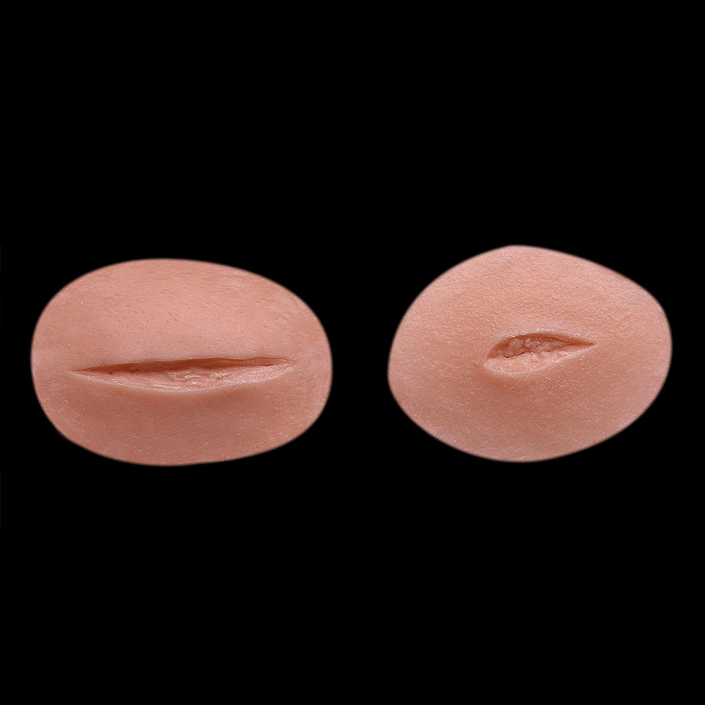 WD20 - Incision Set
