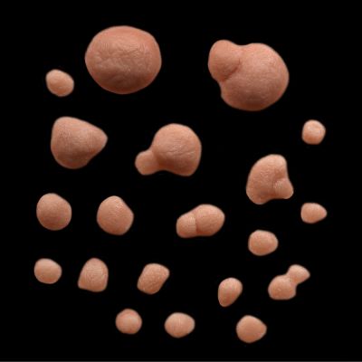 WR1 - Set of Small Warts