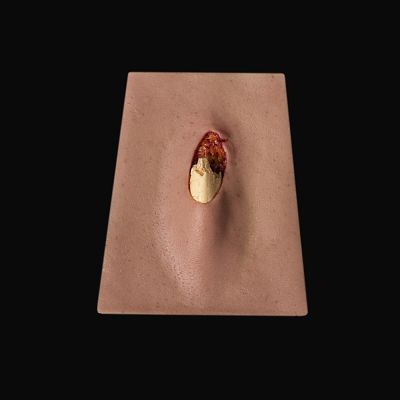 OF1 - Open Fracture Small